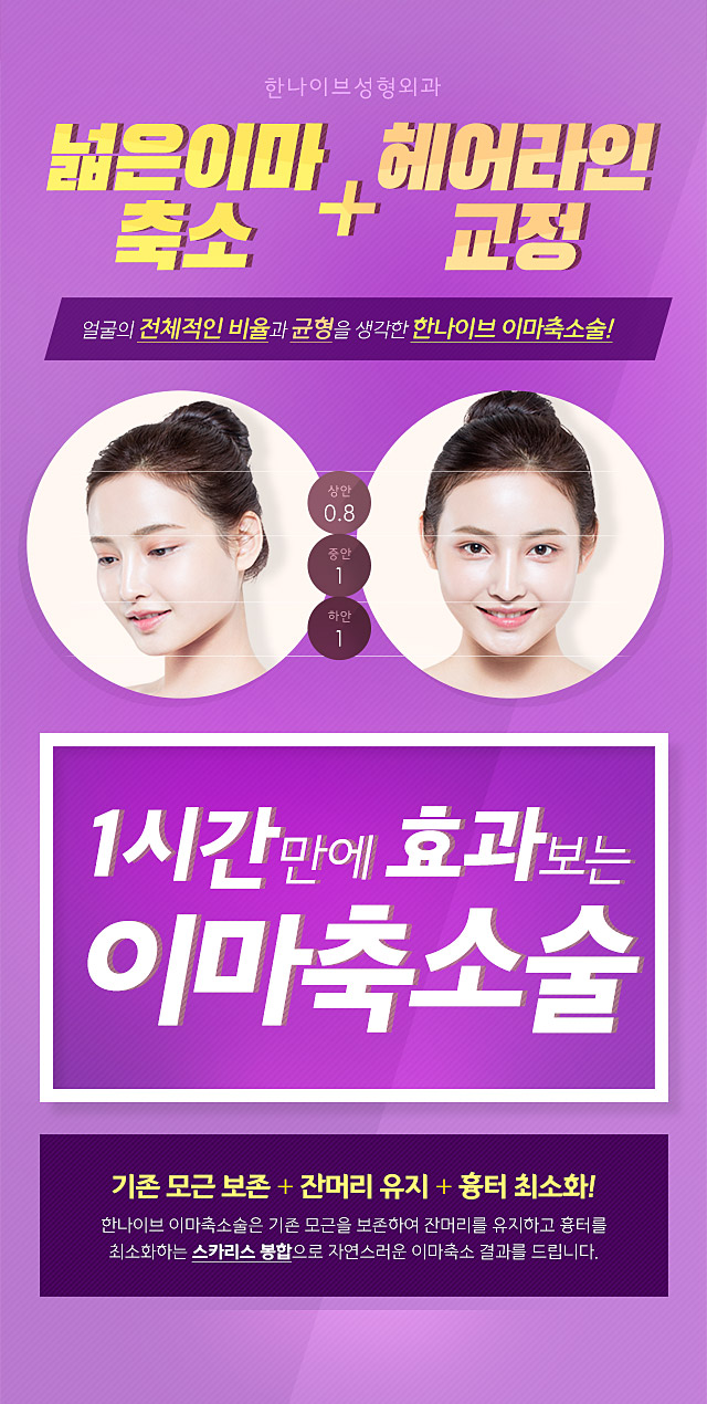 넓은이마축소와헤어라인교정을동시에